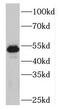 PLAG1 Like Zinc Finger 1 antibody, FNab06516, FineTest, Western Blot image 