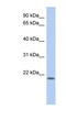ChaC Cation Transport Regulator Homolog 2 antibody, NBP1-56821, Novus Biologicals, Western Blot image 