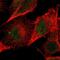 Zinc Finger Protein 267 antibody, NBP1-81633, Novus Biologicals, Immunocytochemistry image 