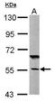 DnaJ Heat Shock Protein Family (Hsp40) Member C7 antibody, GTX104079, GeneTex, Western Blot image 