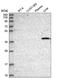 Cyclin Dependent Kinase 8 antibody, NBP2-55134, Novus Biologicals, Western Blot image 