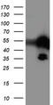TAL BHLH Transcription Factor 1, Erythroid Differentiation Factor antibody, TA503897S, Origene, Western Blot image 