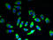 Sodium/glucose cotransporter 2 antibody, A63450-100, Epigentek, Immunofluorescence image 