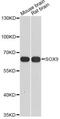 SRY-Box 9 antibody, A2479, ABclonal Technology, Western Blot image 