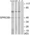 G-protein coupled receptor family C group 5 member B antibody, A30826, Boster Biological Technology, Western Blot image 
