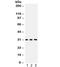 PRDX4 antibody, R32208, NSJ Bioreagents, Western Blot image 