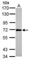 RNA Binding Motif Protein 39 antibody, GTX118112, GeneTex, Western Blot image 