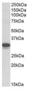 Cytochrome B5 Reductase 3 antibody, AP23661PU-N, Origene, Western Blot image 