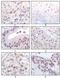 Probable histone acetyltransferase MYST1 antibody, MA5-15345, Invitrogen Antibodies, Immunohistochemistry frozen image 