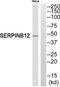 Serpin Family B Member 12 antibody, TA315961, Origene, Western Blot image 