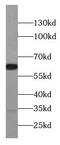 Cholecystokinin B Receptor antibody, FNab01378, FineTest, Western Blot image 