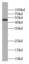 Retinoid-inducible serine carboxypeptidase antibody, FNab07316, FineTest, Western Blot image 