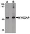 Myocardial Zonula Adherens Protein antibody, PA5-21116, Invitrogen Antibodies, Western Blot image 