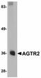 Angiotensin II Receptor Type 2 antibody, LS-C108589, Lifespan Biosciences, Western Blot image 