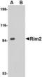 Regulating Synaptic Membrane Exocytosis 2 antibody, TA306577, Origene, Western Blot image 