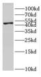 GDP-Mannose Pyrophosphorylase A antibody, FNab03526, FineTest, Western Blot image 