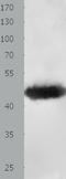 Methionine Adenosyltransferase 1A antibody, TA321126, Origene, Western Blot image 