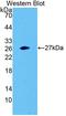 Synaptosome Associated Protein 23 antibody, LS-C702963, Lifespan Biosciences, Western Blot image 