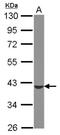 ST6 N-Acetylgalactosaminide Alpha-2,6-Sialyltransferase 4 antibody, NBP2-20495, Novus Biologicals, Western Blot image 