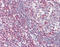Zeta Chain Of T Cell Receptor Associated Protein Kinase 70 antibody, ADI-905-681-100, Enzo Life Sciences, Immunohistochemistry paraffin image 