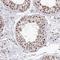 Exosome Component 3 antibody, NBP1-91874, Novus Biologicals, Immunohistochemistry frozen image 