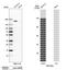 Zinc Finger MYND-Type Containing 8 antibody, HPA020949, Atlas Antibodies, Western Blot image 