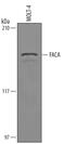 FA Complementation Group A antibody, AF6026, R&D Systems, Western Blot image 