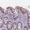 RING finger protein 170 antibody, NBP2-48986, Novus Biologicals, Immunohistochemistry paraffin image 