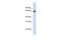 UDP Glucuronosyltransferase Family 1 Member A7 antibody, PA5-43352, Invitrogen Antibodies, Western Blot image 