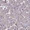 Protein Phosphatase 2 Regulatory Subunit Bbeta antibody, HPA042122, Atlas Antibodies, Immunohistochemistry paraffin image 