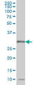 DNA-3-methyladenine glycosylase antibody, LS-C133328, Lifespan Biosciences, Western Blot image 