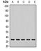 NSF Attachment Protein Alpha antibody, abx142032, Abbexa, Western Blot image 