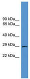 Aquaporin 2 antibody, TA335241, Origene, Western Blot image 