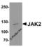 Janus Kinase 2 antibody, 8085, ProSci Inc, Western Blot image 