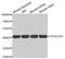 SH3 Domain Containing GRB2 Like, Endophilin B1 antibody, MBS128734, MyBioSource, Western Blot image 