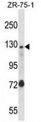 Ubiquitination Factor E4A antibody, AP54445PU-N, Origene, Western Blot image 