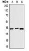 ALX Homeobox 3 antibody, LS-C353885, Lifespan Biosciences, Western Blot image 