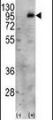 Phosphatidylinositol-4-Phosphate 5-Kinase Type 1 Gamma antibody, PA5-15284, Invitrogen Antibodies, Western Blot image 