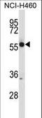 Collapsin Response Mediator Protein 1 antibody, LS-C167051, Lifespan Biosciences, Western Blot image 
