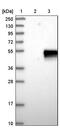Carbonic Anhydrase 12 antibody, PA5-52608, Invitrogen Antibodies, Western Blot image 