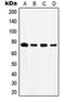 Carnitine O-Acetyltransferase antibody, orb341052, Biorbyt, Western Blot image 