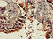DENN Domain Containing 1C antibody, CSB-PA810272LA01HU, Cusabio, Immunohistochemistry paraffin image 