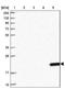 Dynactin Subunit 5 antibody, NBP1-81122, Novus Biologicals, Western Blot image 