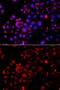 Snail Family Transcriptional Repressor 2 antibody, GTX32879, GeneTex, Immunofluorescence image 