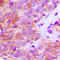 Fibroblast Growth Factor Receptor 3 antibody, LS-C352196, Lifespan Biosciences, Immunohistochemistry paraffin image 