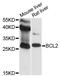 BCL2 antibody, A0208, ABclonal Technology, Western Blot image 