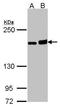 DIAPH1 antibody, GTX102057, GeneTex, Western Blot image 