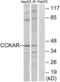 Cholecystokinin receptor type A antibody, LS-C120637, Lifespan Biosciences, Western Blot image 