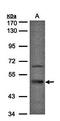 Somatostatin receptor type 5 antibody, orb11424, Biorbyt, Western Blot image 