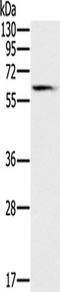 Solute carrier family 45 member 3 antibody, TA351498, Origene, Western Blot image 